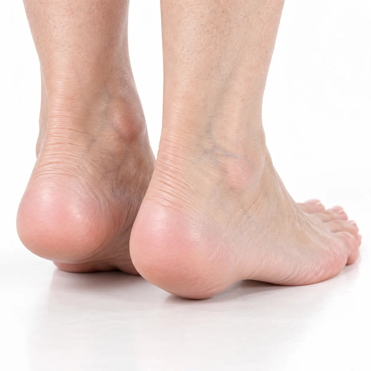 Urea And Salicylic Acid Hand And Foot Stick