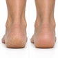Urea And Salicylic Acid Hand And Foot Stick