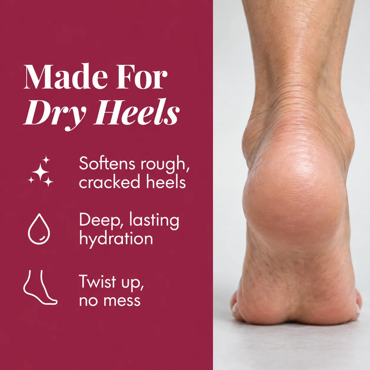 Urea And Salicylic Acid Hand And Foot Stick