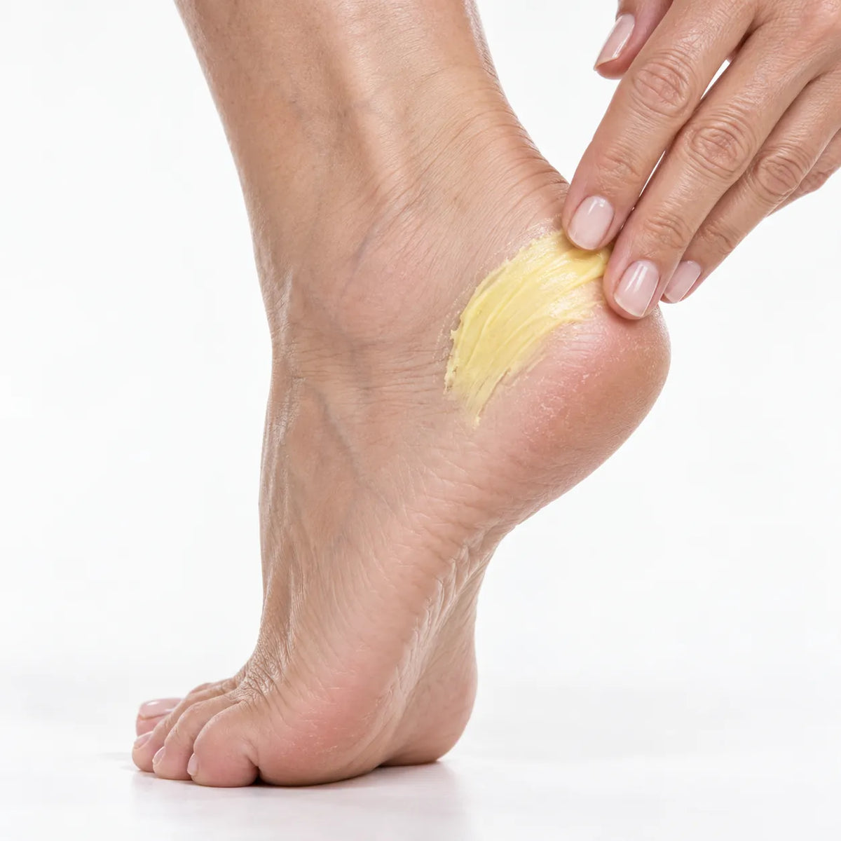 Urea And Salicylic Acid Hand And Foot Stick