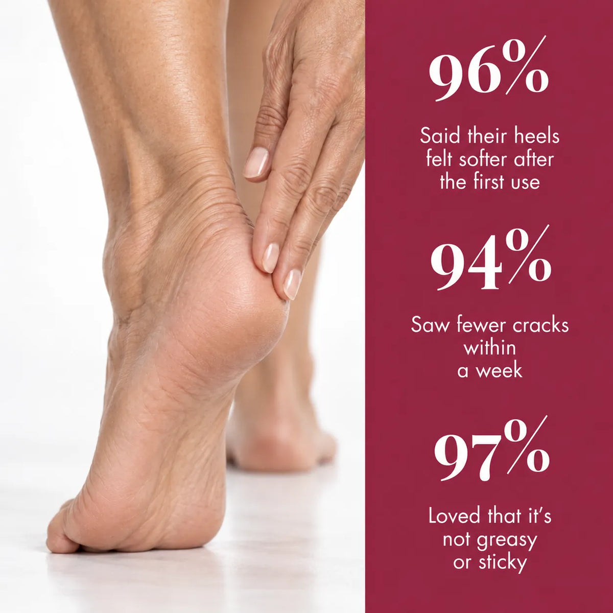 Urea And Salicylic Acid Hand And Foot Stick
